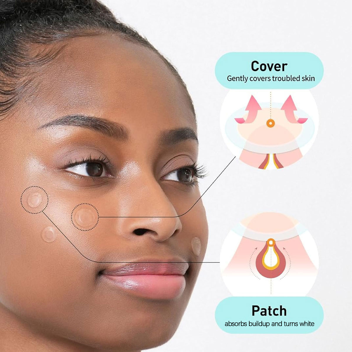 Olive Young Care Plus Spot Cov - Skincare You avis et prix