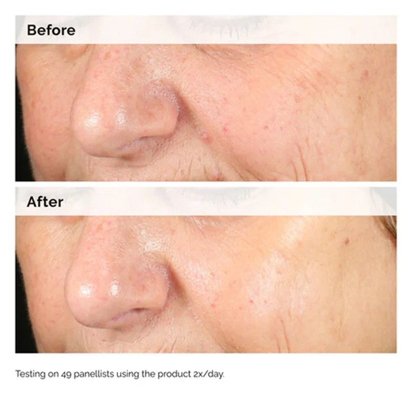 Alpha Arbutin 2% + HA 30ml Ser - Skincare Oily Skin avis et prix