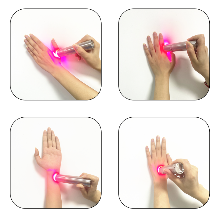 Home Facial Device Skincare Wa - Skincare You avis et prix