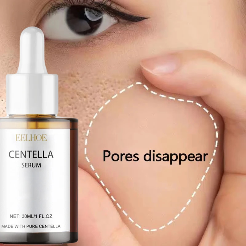 Centella Asiatica Face Serum N - Skincare Oily Skin avis et prix